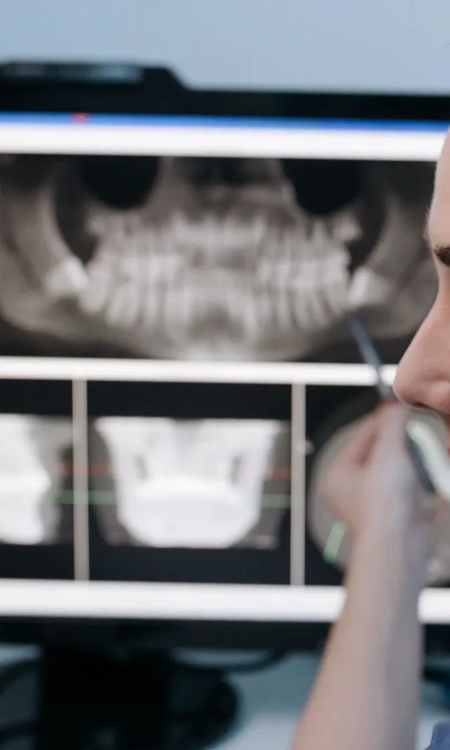 Xray